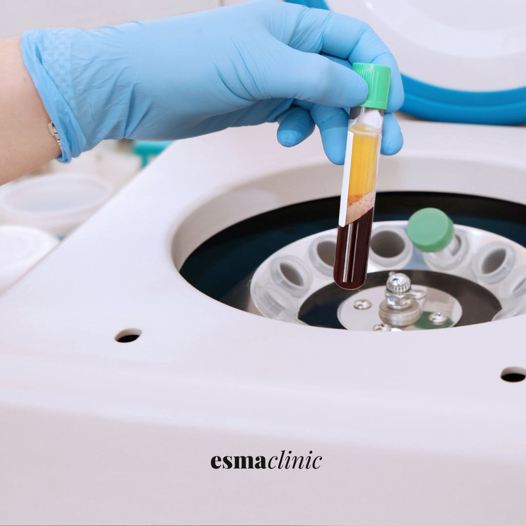 PRP Skin Rejuvenation