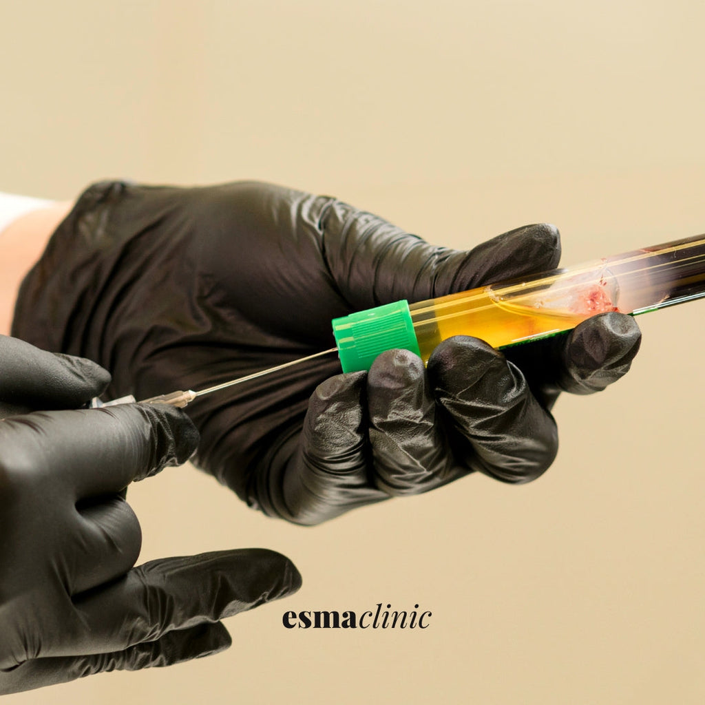 PRP Skin Rejuvenation