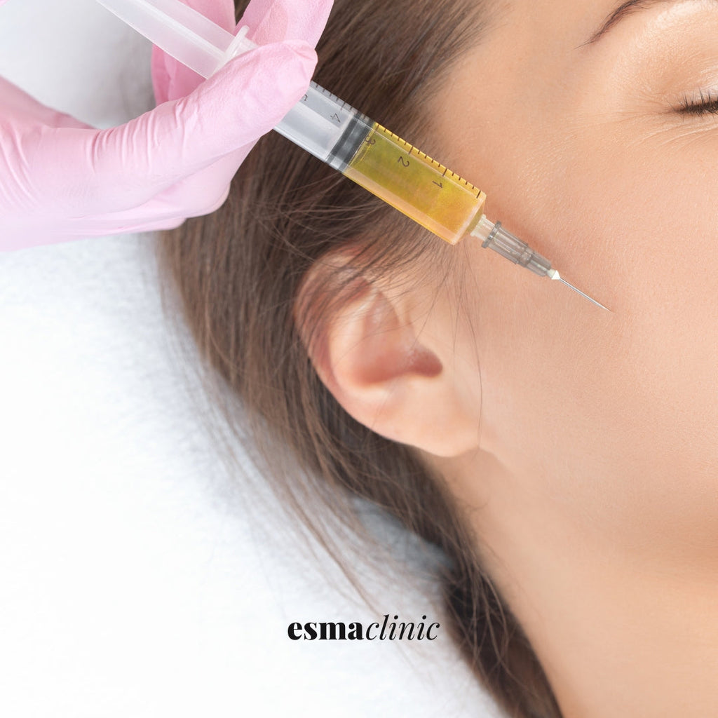 PRP Skin Rejuvenation