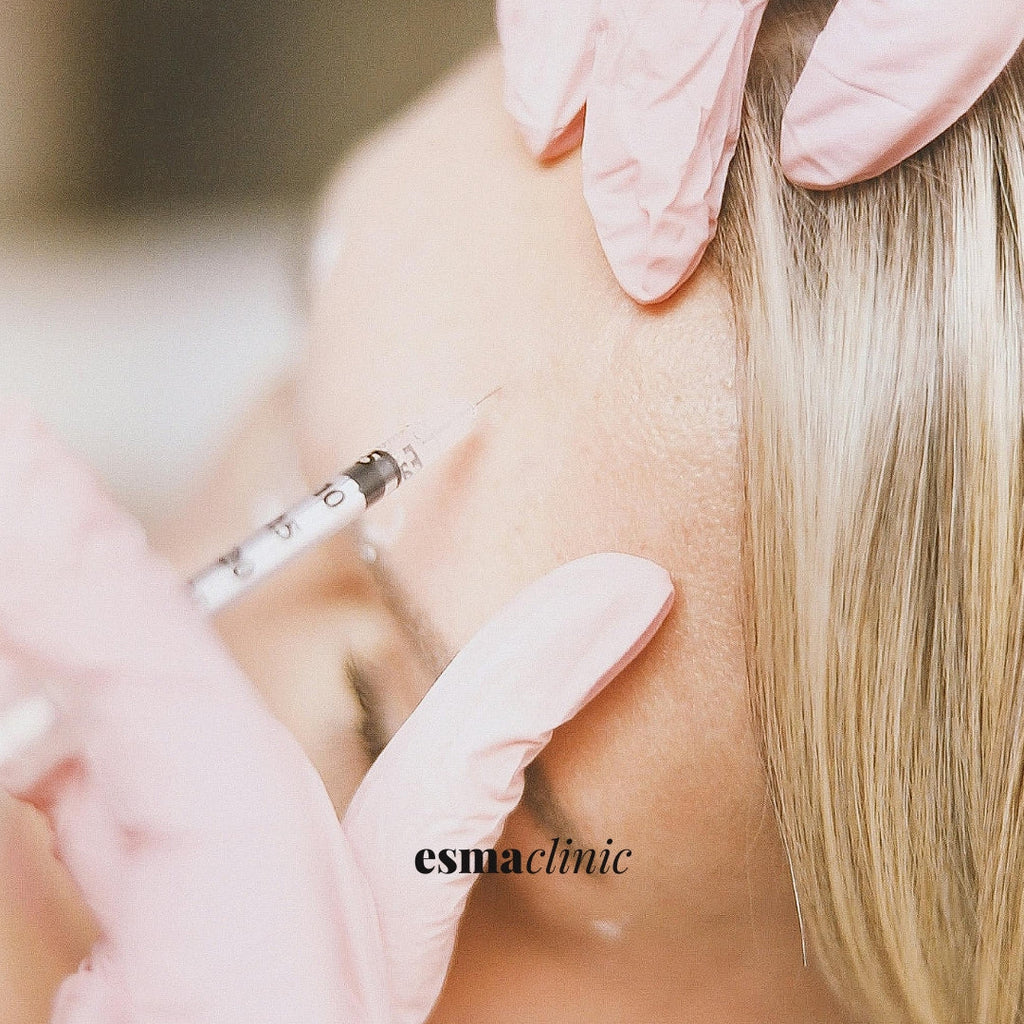 Microneedling